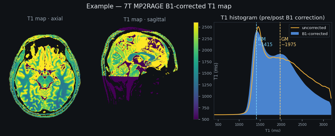 Example: UNI, B1-corrected T1 map, B1 map, and T1 histogram